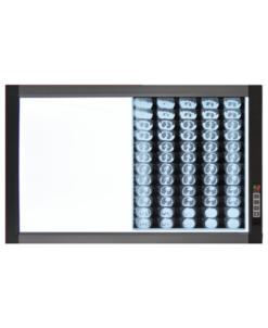 Negatoscopio Led De Doble Panel